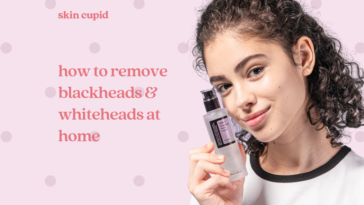 How To Get Rid of Blackheads and Whiteheads at Home