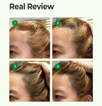 SOME BY MI Hair Cica Peptide Anti Hair Loss Shampoo (285ml) Before and after reviews